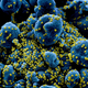 Imagen para el artículo titulado Este es el aspecto del coronavirus atacando una célula humana bajo el microscopio electrónico